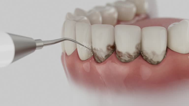 Reliable Wisdom Tooth Removal contractor in Lauderdale County County, AL by Dentist Open Now